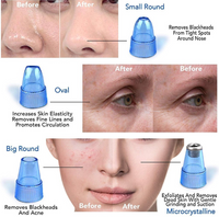 Vaccum blackhead cleansor